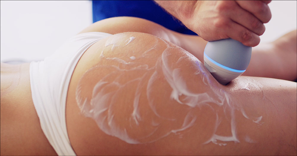 Handheld device treating cellulite on a thigh with gel at our Korte van Eeghenstraat clinic, EMtone cellulite reduction Amsterdam